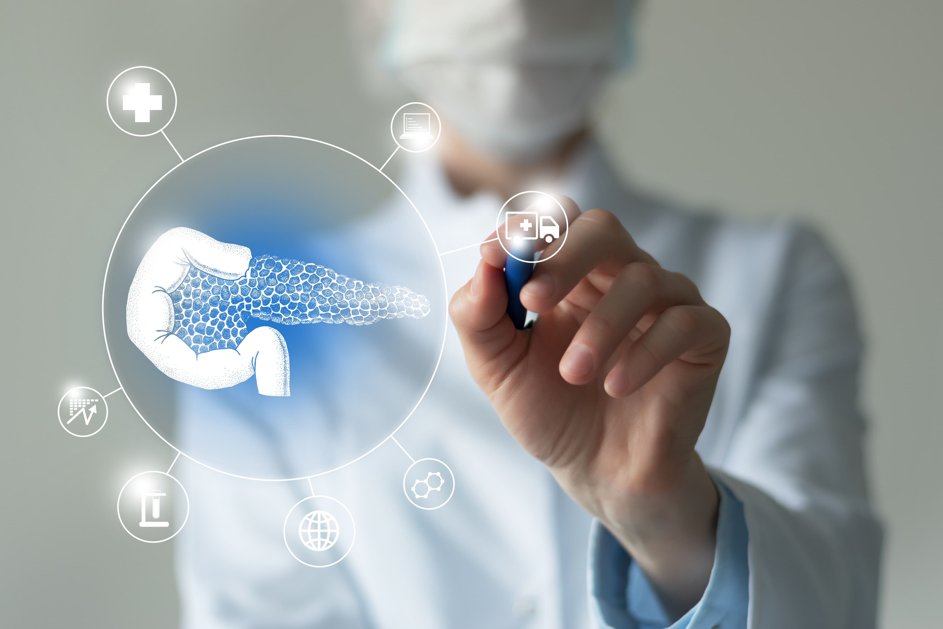 Tumore del pancreas: al policlinico Gemelli di Roma due trial clinici con daraxonrasib, il farmaco che raddoppia la sopravvivenza nei pazienti trattati in seconda linea. Come funziona l'accesso alle sperimentazioni e come si distinguono