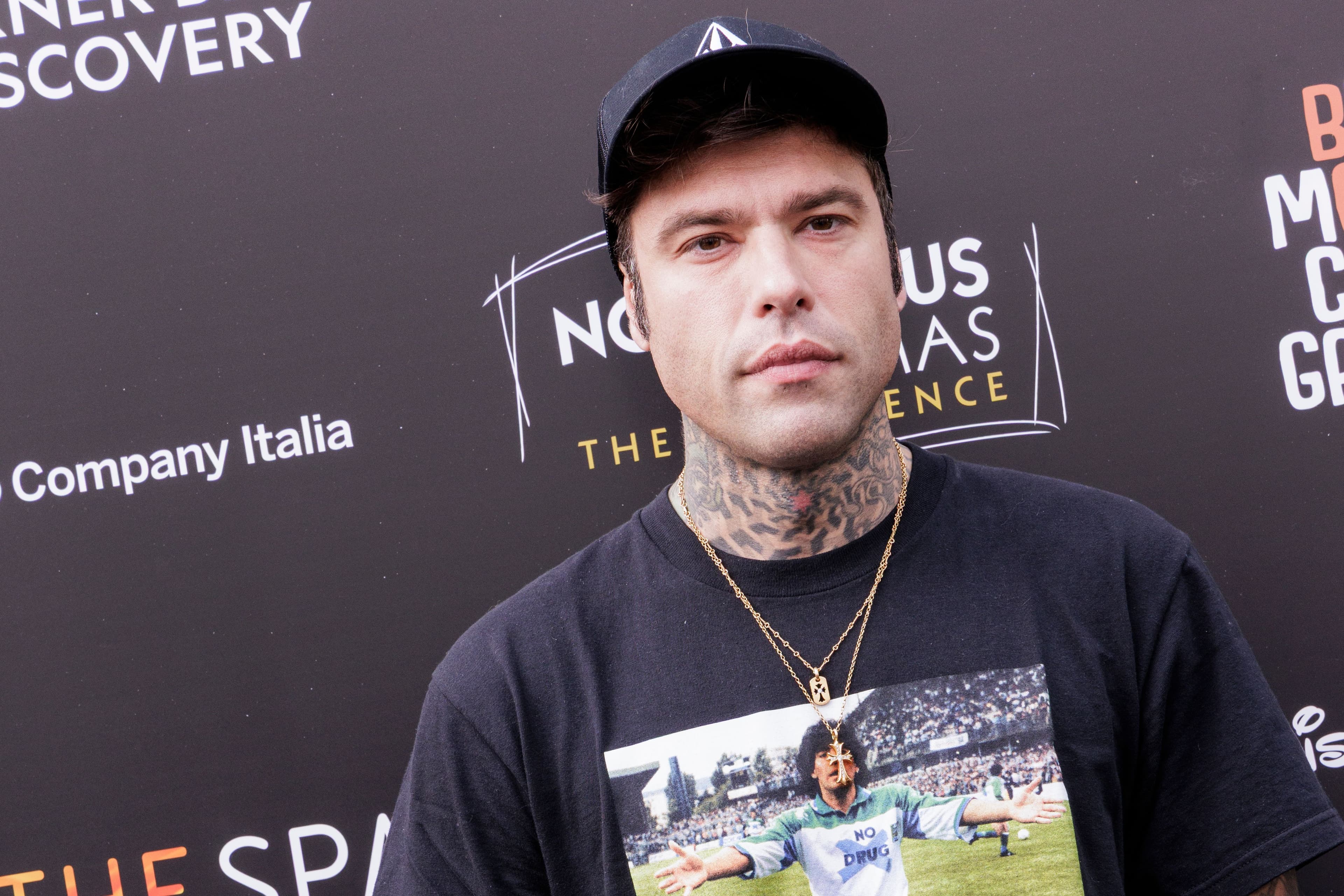 Fedez dimesso dall'ospedale, come sta dopo il ricovero