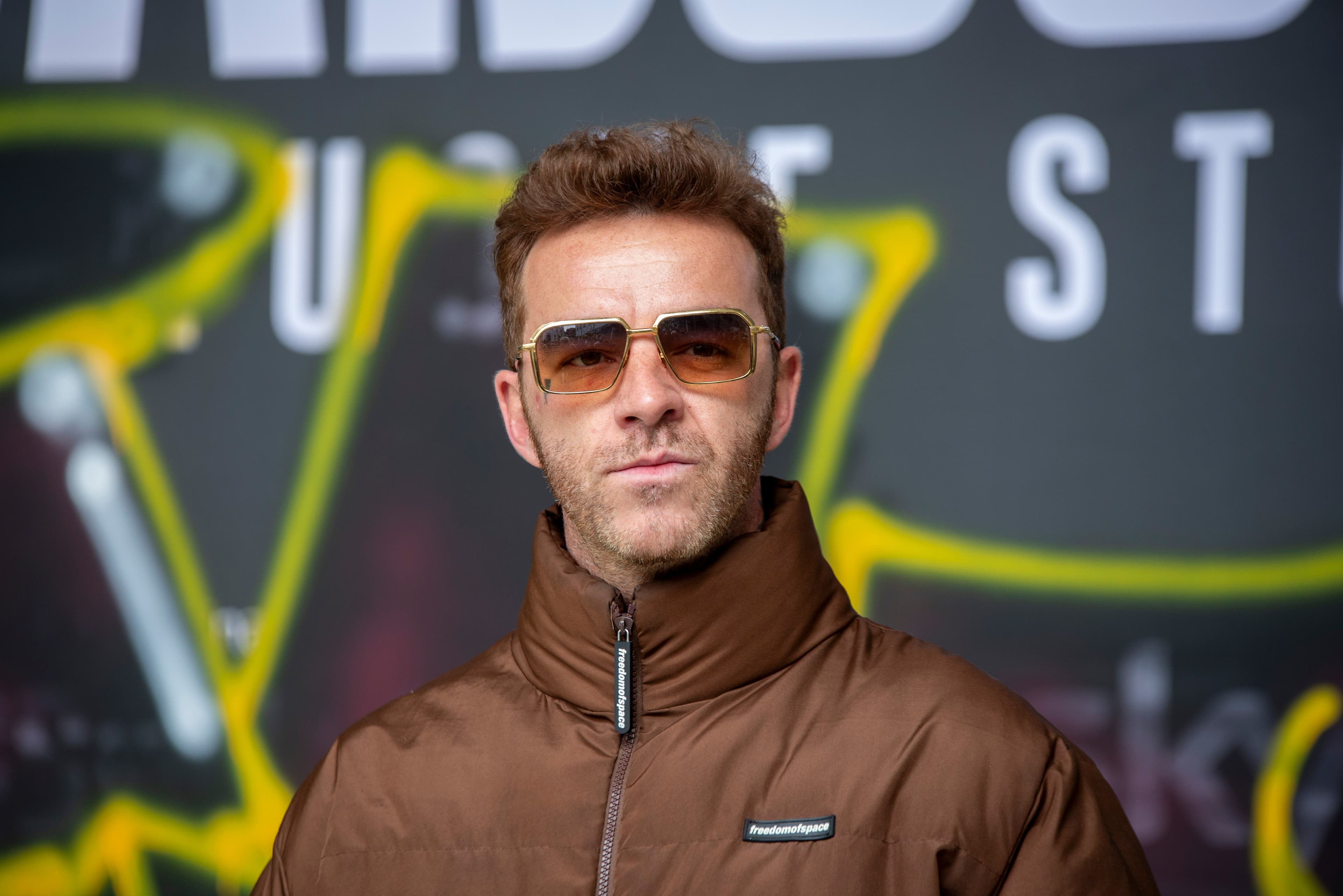 Salmo e l'annuncio social: «Cancro della pelle, questa è la cicatrice». Che cos'è il carcinoma basocellulare di cui il rapper ha subito l'asportazione