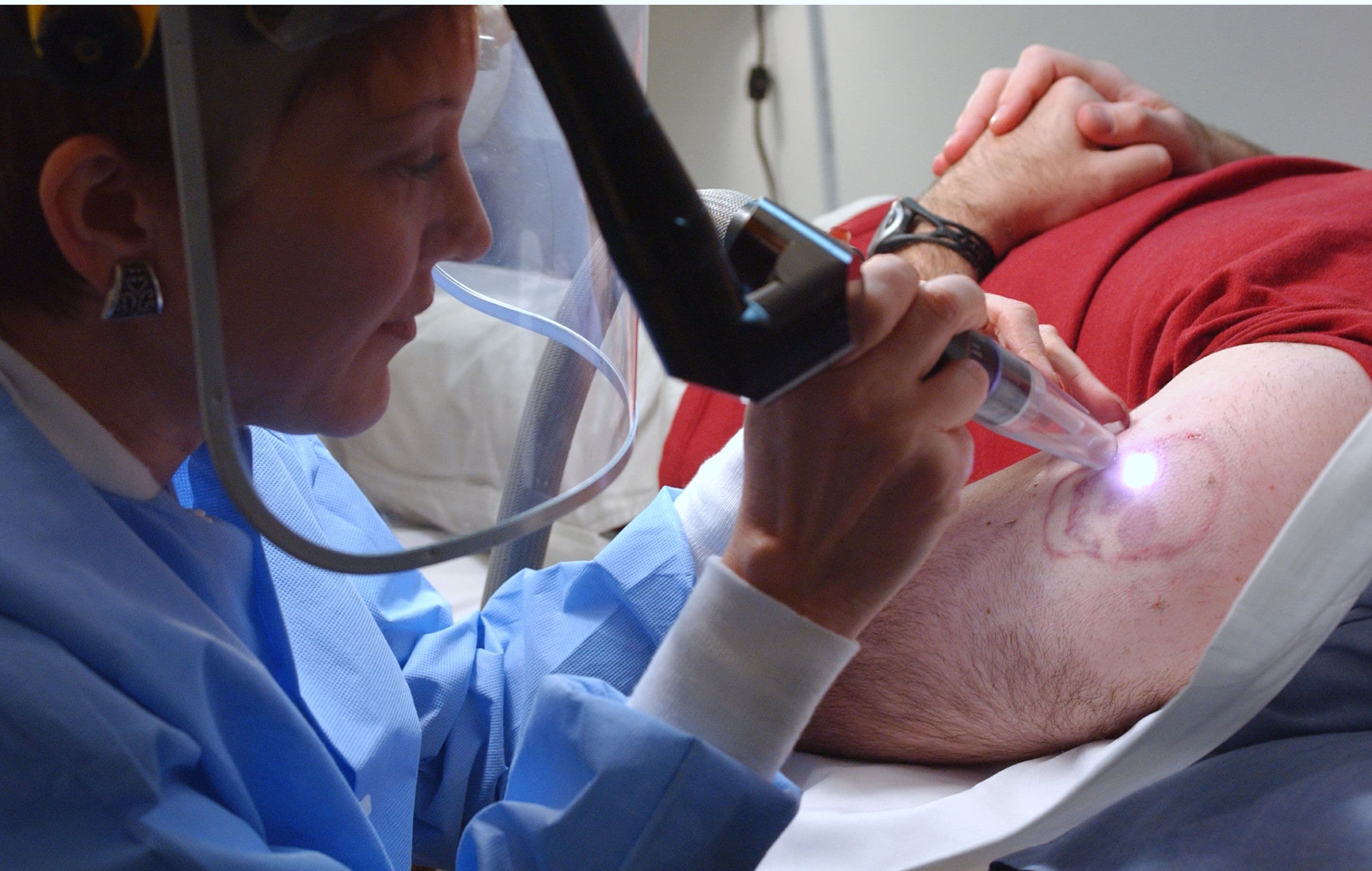 Tatuaggi, quando arriva il pentimento: come si cancellano e quali rischi si corrono. La dermatologa: «Abbiamo degli strumenti ma non possiamo mai garantire la reversibilità completa, soprattutto per quanto riguarda i pigmenti colorati»